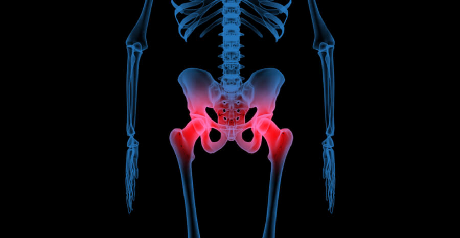 Hip Arthroscopy