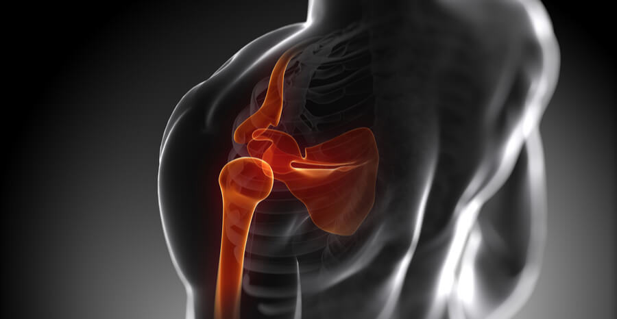 , Shoulder Joint Replacement